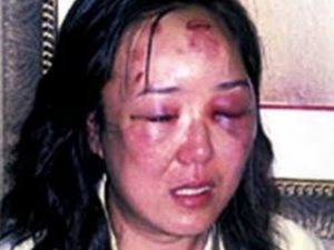 Gương mặt tím tái của Zhao Yan bị đặc vụ Mỹ đánh nhầm năm 2004