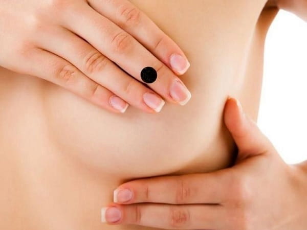 Ý nghĩa chung của nốt ruồi ở nhũ hoa phụ nữ