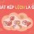 Khái niệm sát kép lệch là gì?